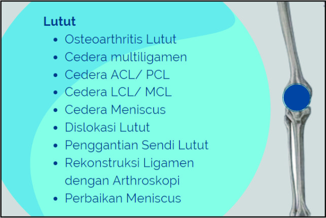 Pelayanan Gadjah Mada Orthopaedic Center - Lutut