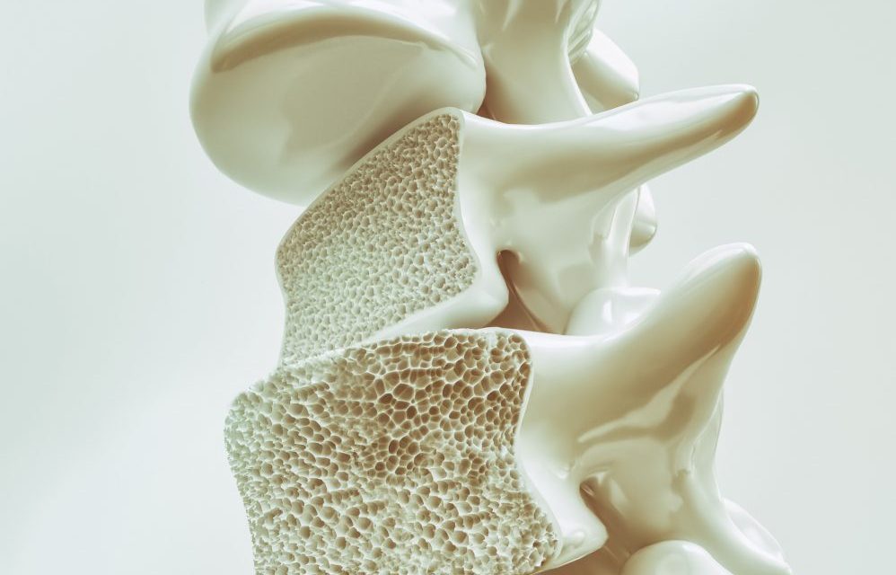 Apakah Osteoporosis Harus Operasi?