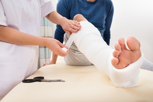 Apakah Patah Tulang Kaki Bisa Sembuh Tanpa Operasi?